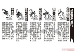 インプラント治療で高額請求 ブラック歯科 にカモられないためのポイント ニュース概要 週刊女性prime インプラント治療で高額請求 ブラック歯科 にカモられないためのポイント ニュース概要 週刊女性prime