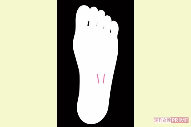 腸に不調の疑い下痢線　イラスト／湯沢知子