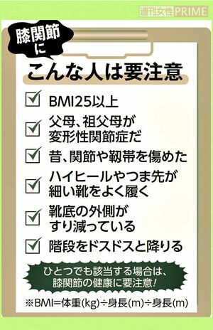 膝関節にこんな人は注意