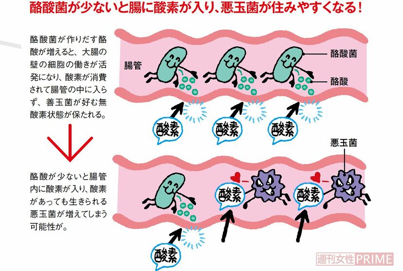 画像 写真 長寿の町 調査で判明 悪玉菌を退治する 酪酸菌 の増やし方と長生き食事法 週刊女性prime