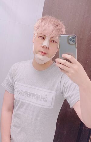 手術7日後の様子。一生このままなのではという不安と生まれ変われるワクワクが同時にあったそう