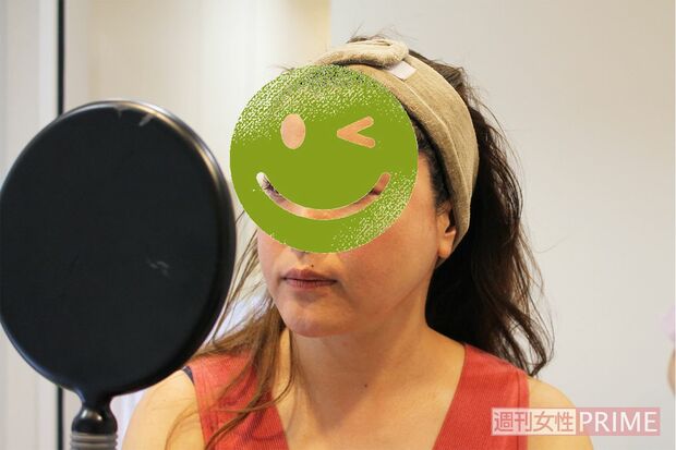 フェイスラインが上がっただけでなく、まぶたがスッキリして軽くなり、目が開けやすくなった