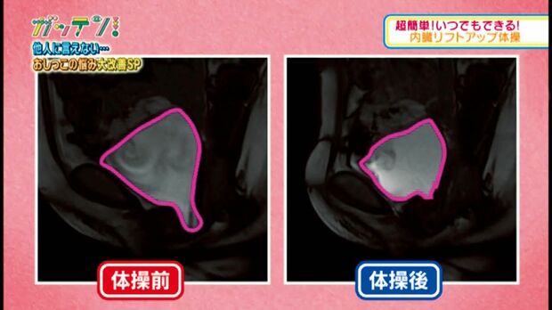 高橋さんのMRI画像