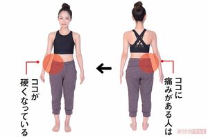 痛みの原因はお腹側の筋肉が硬くなること　撮影／森モーリー鷹博　モデル／辛島菜摘