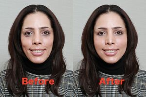 これがフィフィの整形シミュレーション、ビフォー・アフター！