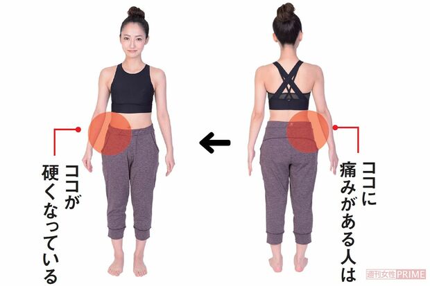 痛みの原因はお腹側の筋肉が硬くなること　撮影／森モーリー鷹博　モデル／辛島菜摘