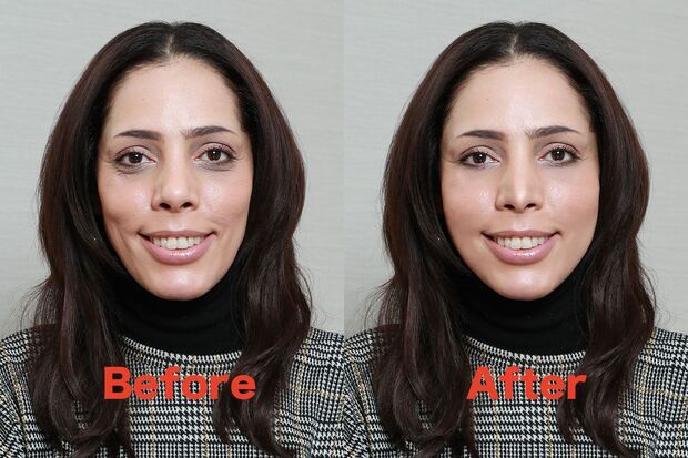 これがフィフィの整形シミュレーション、ビフォー・アフター！