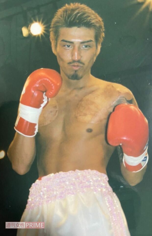 現役時代の大嶋さん。胸部は入れ墨を消した痛々しい後が残る