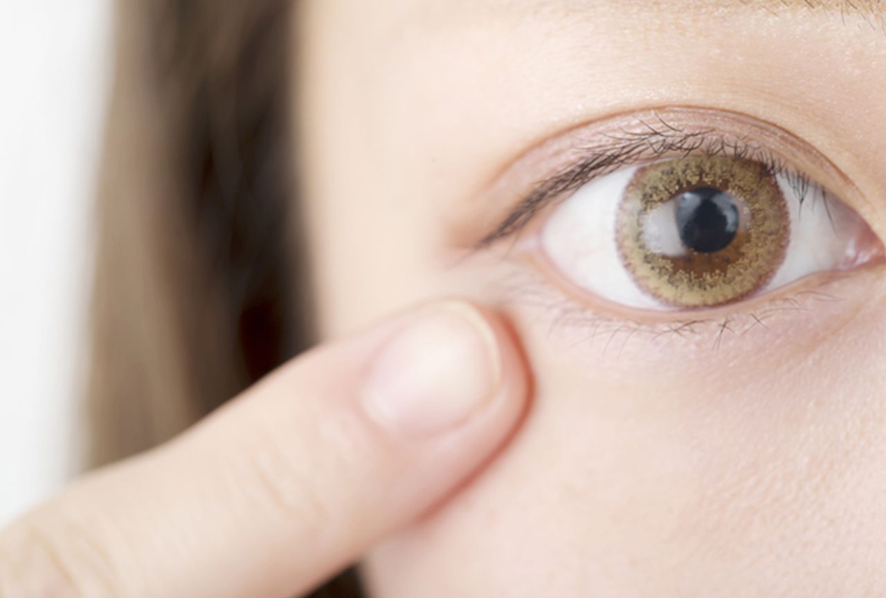 女性の大半が予備軍の 眼瞼下垂 専門医に聞く 理想の目に生まれ変わる治療法 週刊女性prime