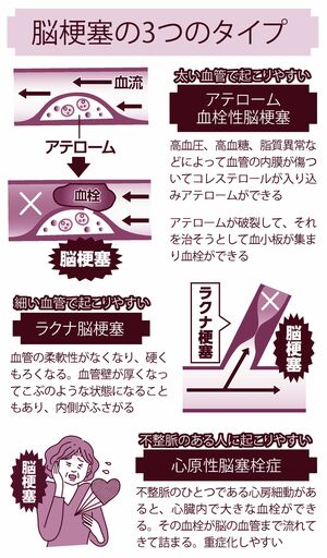 イラスト／大塚さやか