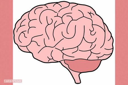 脳のゴミ、アミロイドβが脳内に蓄積すると、脳細胞が活発でなくなり、数も減少する