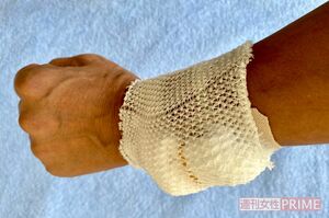 点滴で抗がん剤と生理食塩水を投与。7時間ほどかかることも