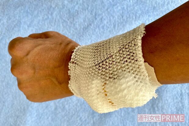 点滴で抗がん剤と生理食塩水を投与。7時間ほどかかることも