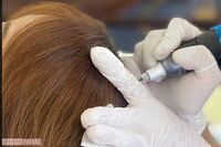 “頭皮にお絵描き”で薄毛カバー! 40代女性編集者が体当たりレポート「韓国ヘア美容」の驚くべき効果と専…
