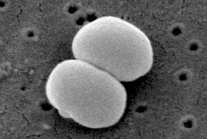 美肌菌の大きさは、1マイクロメートル(1mmの1000分の1)。肉眼では目視できないけれど、存在している。(C)CDC,JaniceCarr