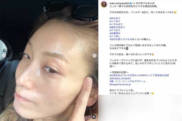 《夕方の自然光の元、フィルター&加工、外して向き合ってみた》とすっぴんショットを投稿した西山茉希(本人のインスタグラムより)