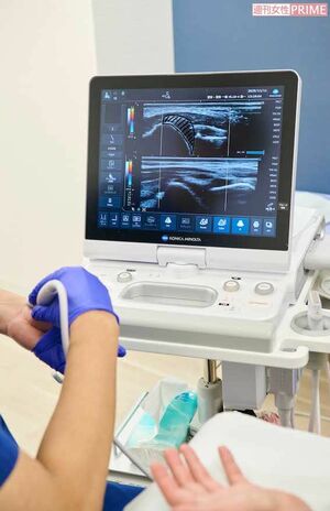 上が柏屋コッコさんの関節。滑膜の腫れが見てとれる。下が先生の正常な関節