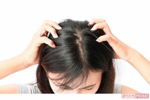 冬の乾燥トラブルから頭皮と髪を守る！正しい「お湯シャンプー」でお悩み改善