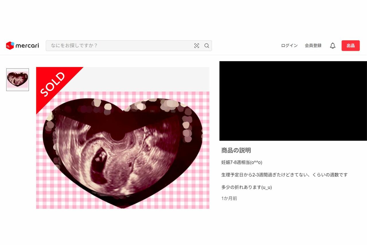 メルカリに“妊娠エコー写真”などの闇深アイテムが大量出品「詐欺以外何に使う？」無法地帯に求められる規制強化 | 週刊女性PRIME