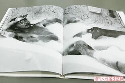 右手の指と手のひらには、傷を隠す白いテープが（撮影／宮澤正明）