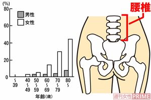 年齢別骨粗しょう症の割合　出典:骨粗しょう症の予防と治療ガイドラインより