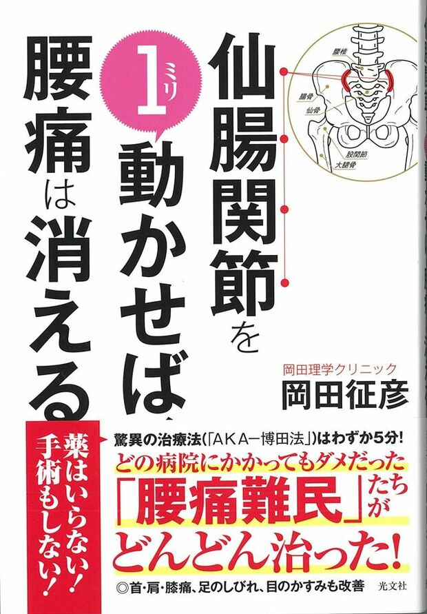 岡田院長の著書『仙腸関節を1ミリ動かせば、腰痛は消える』（光文社刊、本体1200円+税）　※記事の中で画像をクリックするとamazonの紹介ページに移動します