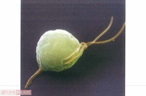 らせん状が特徴のトレポネーマ菌