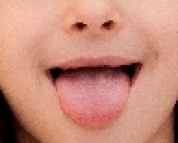 舌の様子を見れば一発でわかる健康状態 6つの着眼点とは ニュース概要 週刊女性prime