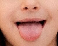 舌の様子を見れば一発でわかる健康状態、6つの着眼点とは