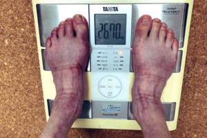 体重測定も「儀式」のひとつ。本人いわく「自己満足であり、自傷行為」だと。最低体重は24キロだ。写真は宝泉薫氏提供