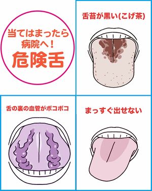 危険舌リスト イラスト/上田惣子