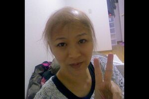 抗がん剤の副作用で脱毛が進んだ2013年の善本さん。1週間でほとんどの毛が抜け落ち、しばらくはウィッグをつけて生活していた