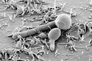 全身の不調を招く腸カビ（カンジダ菌）