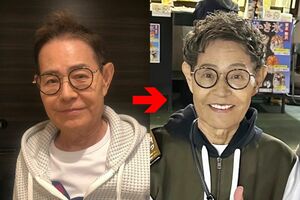 3年でむくみがスッキリ!