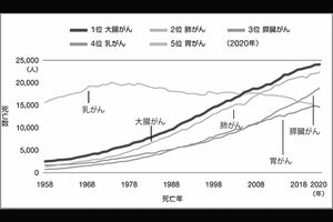 女性が注意すべきがんというと、乳がんや子宮がんを思い浮かべる人が多い。しかし、人口動態調査によれば、2020年の女性のがん死亡原因の1位は大腸がん。男女合わせても近年日本人に急増しているがんのひとつ（出典：国立がん研究センターがん対策情報センター）