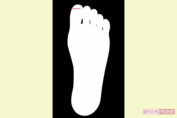 親指に表れる片頭痛線　イラスト／湯沢知子