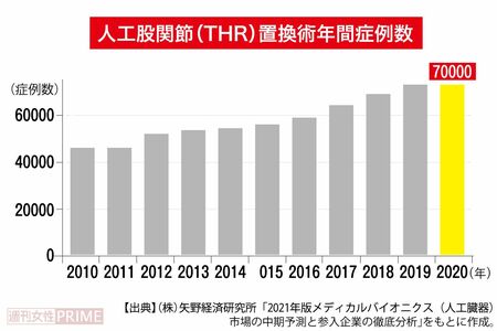 人工股関節（THR）置換術年間症例数