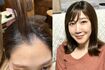 髪が多かったみずきさんだが、1月になると抜け毛も増えている(写真左)。右は完成したウィッグをかぶったところ