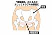 「骨盤底筋」のたるみがおしっこトラブルの原因に