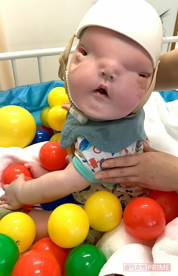 生後9か月のころ。胃ろう手術で入院中のとき、リハビリでボールプールで遊ぶ