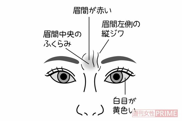 白目の色　イラスト／石崎伸子