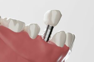 ※写真はイメージです