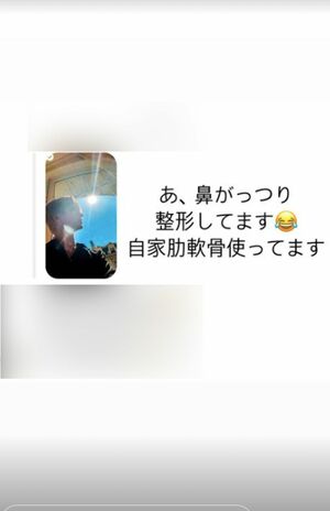 整形していることをSNSで明かしたMatt(本人のインスタグラム、ストーリー機能より)