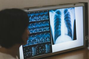 メリットとデメリットを見極め、保険を選ぶことが重要（写真はイメージです）