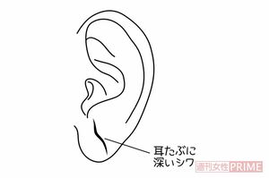 切れそうなくらい深いシワ イラスト/石崎伸子