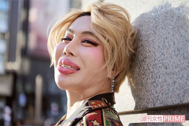 「ヮタクシの歯はジルコニア♪　お直しもすさまじい力がいるの」と語るアレン