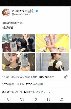 1月下旬、整形を公言している明日花キララが“最新のお顔”と題して複数の顔写真を投稿した（本人Xより）