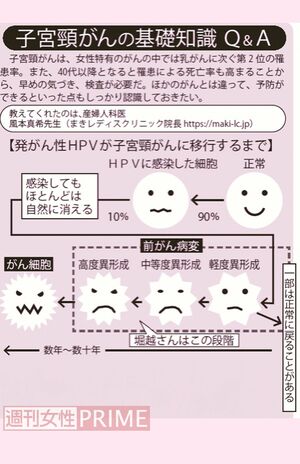 発がん性HPVが子宮頸がんに移行するまで