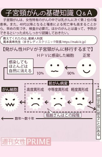 発がん性HPVが子宮頸がんに移行するまで