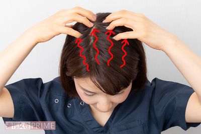 【STEP4】指の腹を頭皮にあて、帽状腱膜を頭蓋骨からはがすようなイメージで生え際から後頭部へ1~2mmずつ動かす。1ラインにつき10秒かけてほぐす